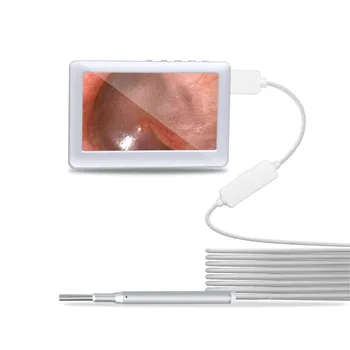 Otoscope Medicīnas 1080P Auss darbības Joma Kamera HD Earwax Endoskopu, USB Pārbaudīt Cam Ausu Aprūpes tīrīšanas Rīks ar 4.3 collu Ekrāns Tālruni 43545