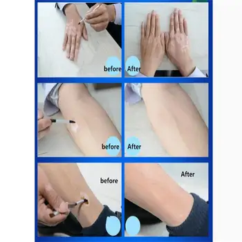 Vitiligo Korektors Būtība Šķidrums,Anti-sviedri ūdensizturīgs,attiecas uz rokām,kājām /sejas /ķermeņa, ārīgi ilgstoši.